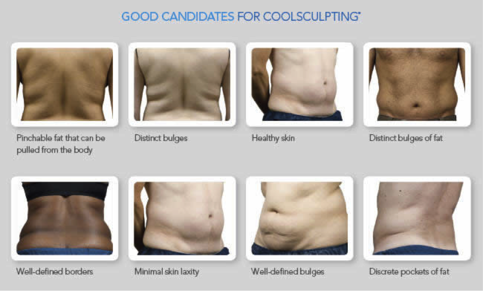 coolsculpting_ideal_candidate
